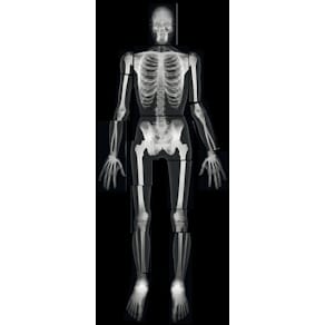 Röntgenbilder komplett människa 18 delar